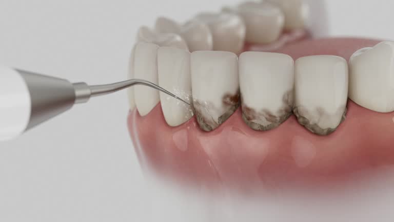 Reliable Dental Implants contractor in Thornton, CO by Smile Center Dentistry